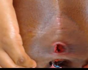 Nauttylatin anal gape